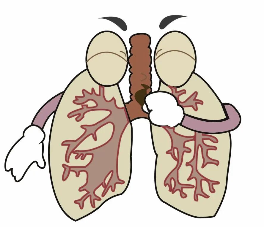 抗栓泵怎么用【健康科普】预防血栓知多少 小肺带你来探讨_https://www.jmylbn.com_新闻资讯_第3张