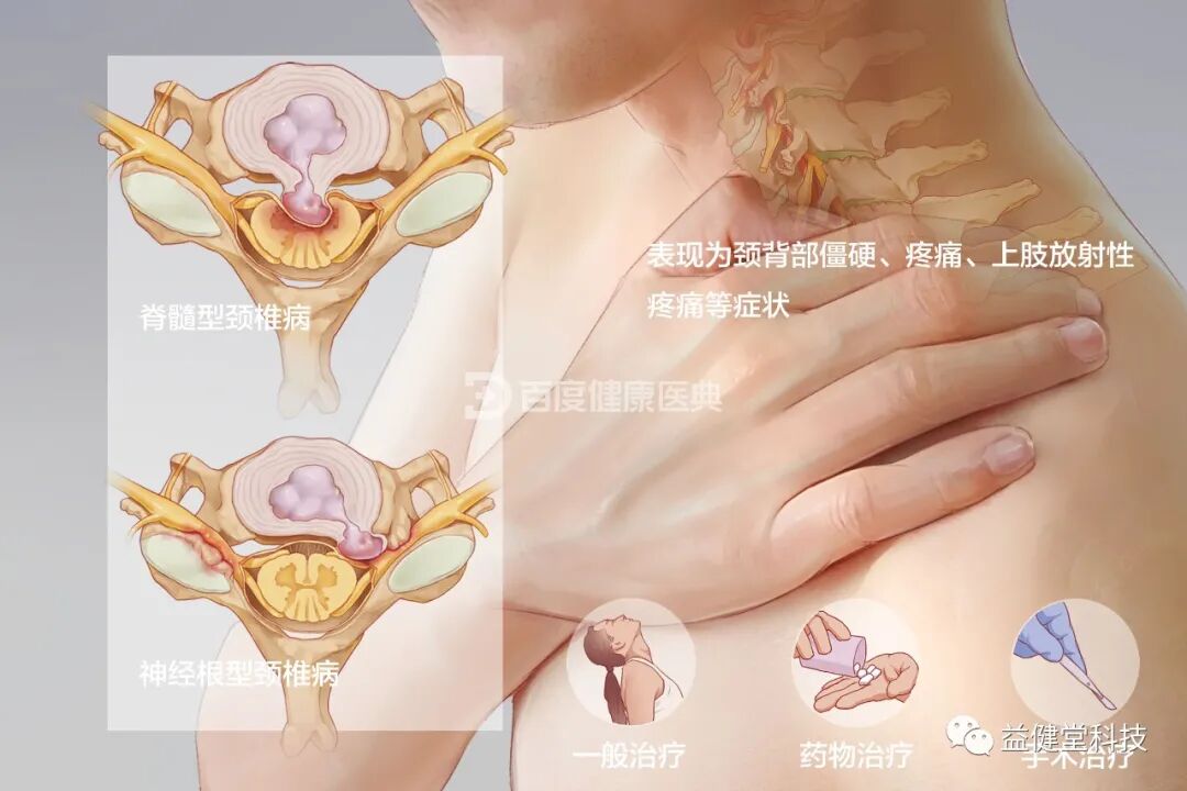 红蓝光治疗仪怎么使用【YJT·健康】益健堂红蓝光治疗仪为什么可以治疗颈椎病？听著名物理医学研究专家朱平教授怎么说_https://www.jmylbn.com_新闻资讯_第1张