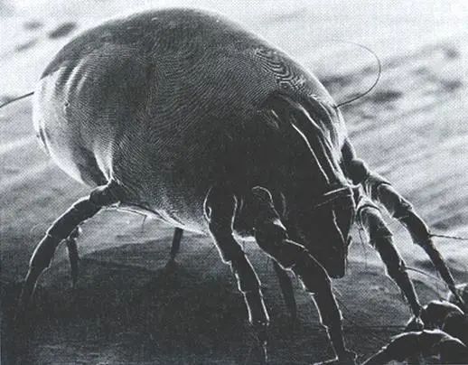 野外的恙螨,其唾液能溶化皮肤组织,引起局部坏死,出现皮炎反应,还可以