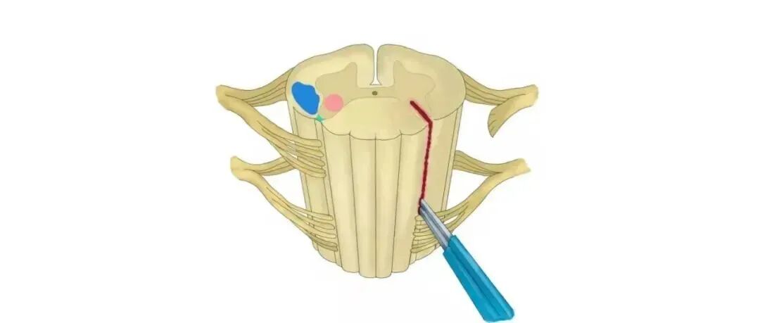 疼痛科怎么理疗义诊活动  ｜ 世界镇痛日、中国疼痛周10.21日-10月25日 我院疼痛科门诊免费义诊！免费理疗！治疗费半价！_https://www.jmylbn.com_新闻资讯_第13张