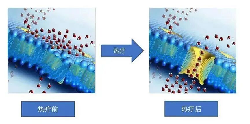 疼痛科怎么理疗义诊活动  ｜ 世界镇痛日、中国疼痛周10.21日-10月25日 我院疼痛科门诊免费义诊！免费理疗！治疗费半价！_https://www.jmylbn.com_新闻资讯_第12张
