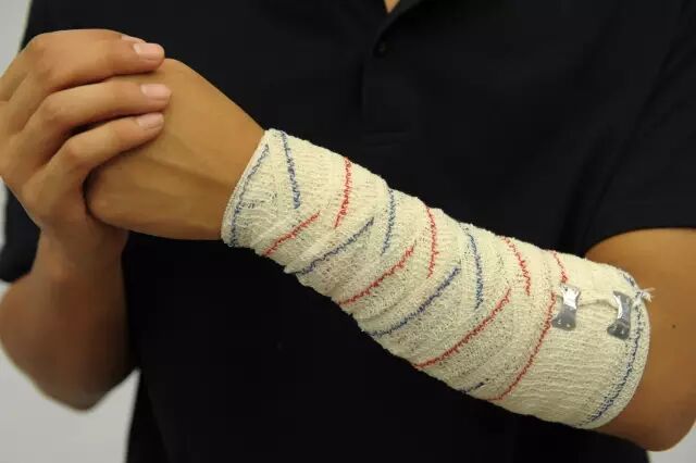 医用绷带怎么绑图解【急救科普】 外伤处理中5种绷带包扎方法，赶紧get!_https://www.jmylbn.com_新闻资讯_第22张