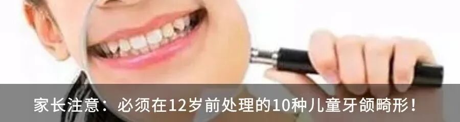 牙胶尖什么颜色【牙医必备】根管治疗中各种器械介绍_https://www.jmylbn.com_新闻资讯_第2张