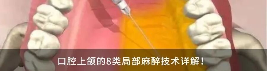 为什么牙医不用开口器【牙医必备】带你认识一下口腔医师的“十八般武器”_https://www.jmylbn.com_新闻资讯_第22张