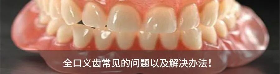 牙胶尖什么颜色【牙医必备】根管治疗中各种器械介绍_https://www.jmylbn.com_新闻资讯_第3张