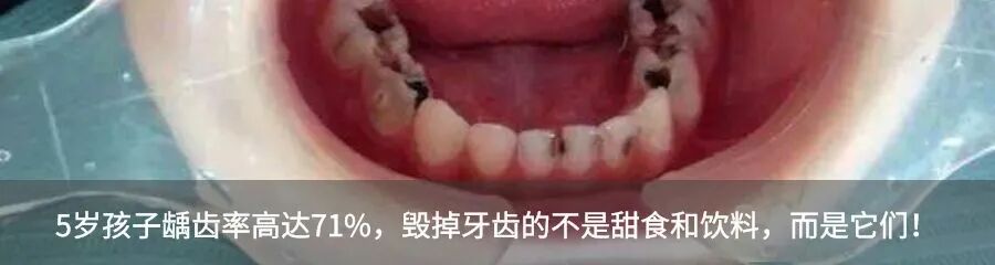 牙胶尖什么颜色【牙医必备】根管治疗中各种器械介绍_https://www.jmylbn.com_新闻资讯_第4张