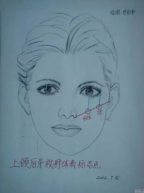 x光机为什么实用牙科X光拍摄技术与心得_https://www.jmylbn.com_新闻资讯_第10张