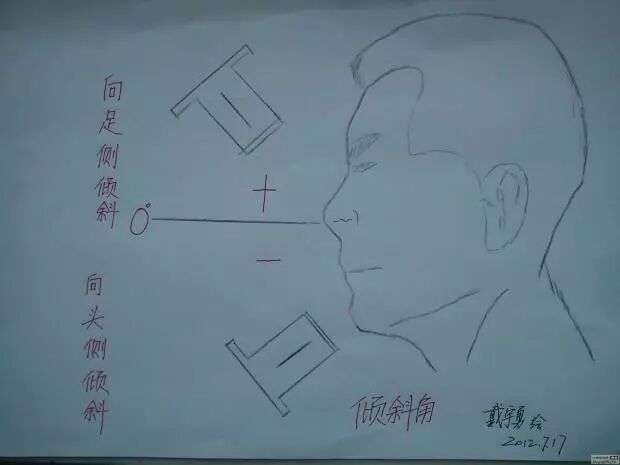 x光机为什么实用牙科X光拍摄技术与心得_https://www.jmylbn.com_新闻资讯_第20张