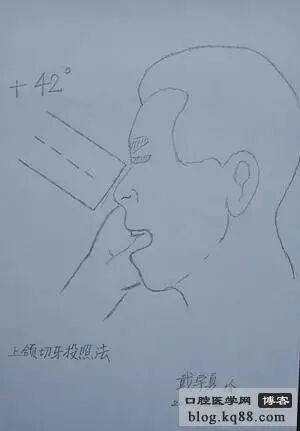 x光机为什么实用牙科X光拍摄技术与心得_https://www.jmylbn.com_新闻资讯_第8张