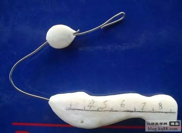 x光机为什么实用牙科X光拍摄技术与心得_https://www.jmylbn.com_新闻资讯_第14张