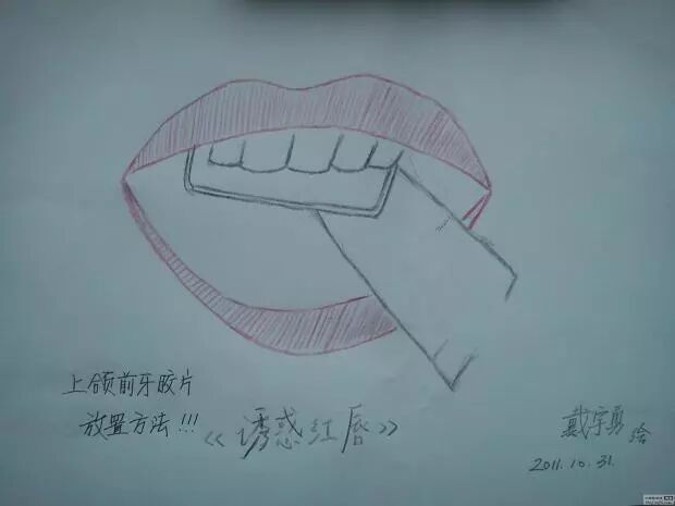 x光机为什么实用牙科X光拍摄技术与心得_https://www.jmylbn.com_新闻资讯_第19张