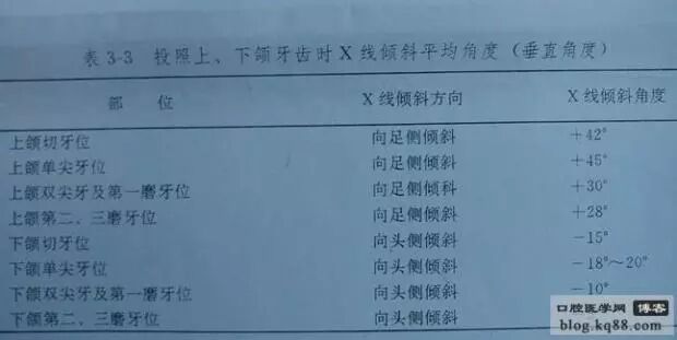 x光机为什么实用牙科X光拍摄技术与心得_https://www.jmylbn.com_新闻资讯_第21张