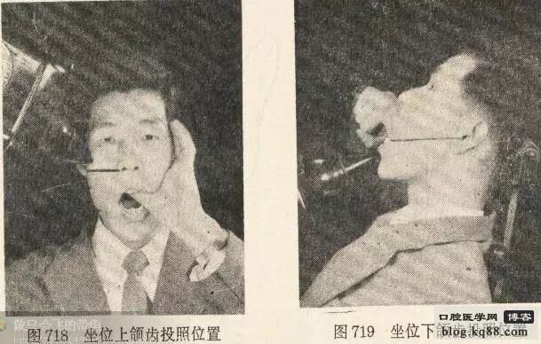 x光机为什么实用牙科X光拍摄技术与心得_https://www.jmylbn.com_新闻资讯_第18张