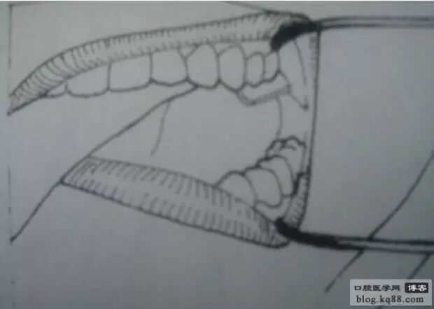 x光机为什么实用牙科X光拍摄技术与心得_https://www.jmylbn.com_新闻资讯_第9张