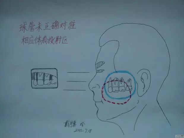 x光机为什么实用牙科X光拍摄技术与心得_https://www.jmylbn.com_新闻资讯_第25张