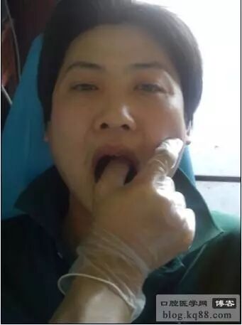 x光机为什么实用牙科X光拍摄技术与心得_https://www.jmylbn.com_新闻资讯_第13张