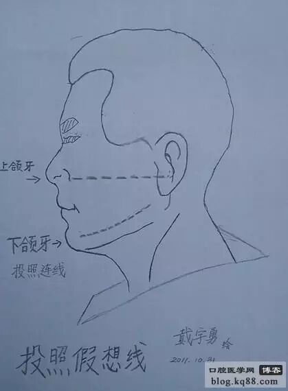 x光机为什么实用牙科X光拍摄技术与心得_https://www.jmylbn.com_新闻资讯_第5张