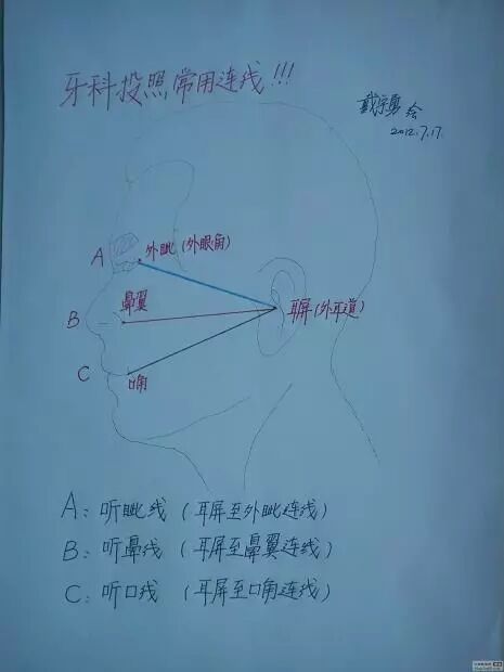 x光机为什么实用牙科X光拍摄技术与心得_https://www.jmylbn.com_新闻资讯_第6张