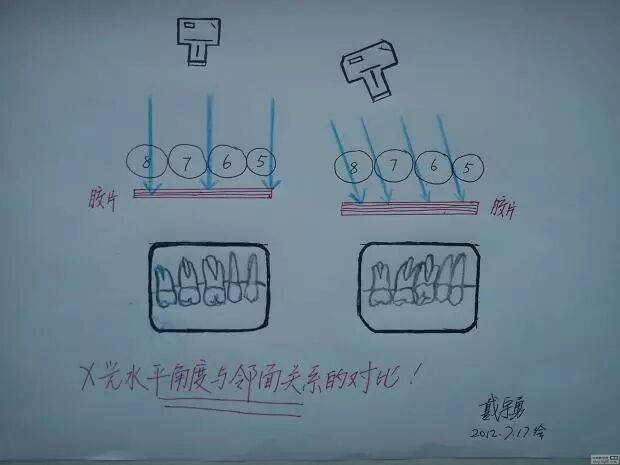 x光机为什么实用牙科X光拍摄技术与心得_https://www.jmylbn.com_新闻资讯_第24张