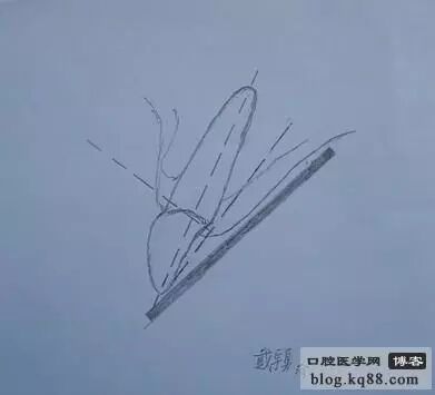 x光机为什么实用牙科X光拍摄技术与心得_https://www.jmylbn.com_新闻资讯_第4张