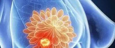 新会陈皮配三七，可能是乳腺问题“最好”的配方！