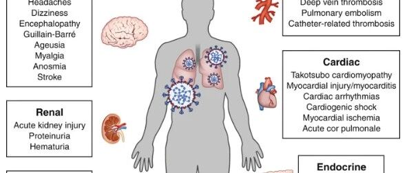 新冠肺炎远比预期复杂，新冠病毒几乎无差别攻击人体各系统！