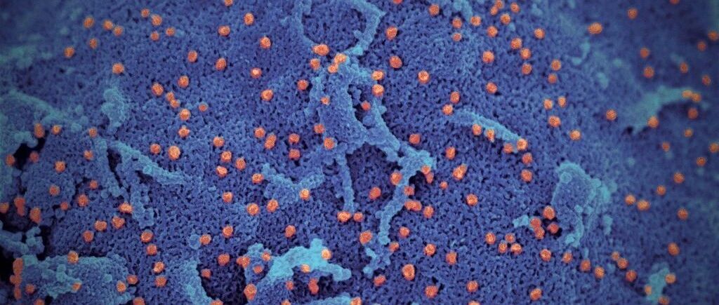 全球惊现更多再感染新冠病例！新冠大流行进入新常态？