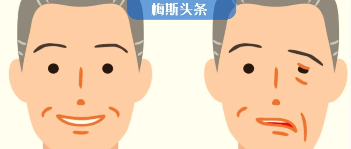 柳叶刀全球卒中报告：每4个25岁以上的人，就有1个会发生脑卒中