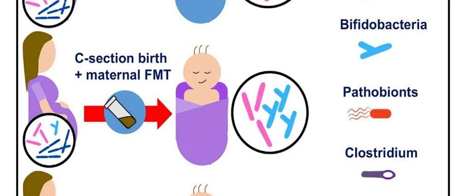 2020年胃肠领域研究进展盘点丨梅斯述评