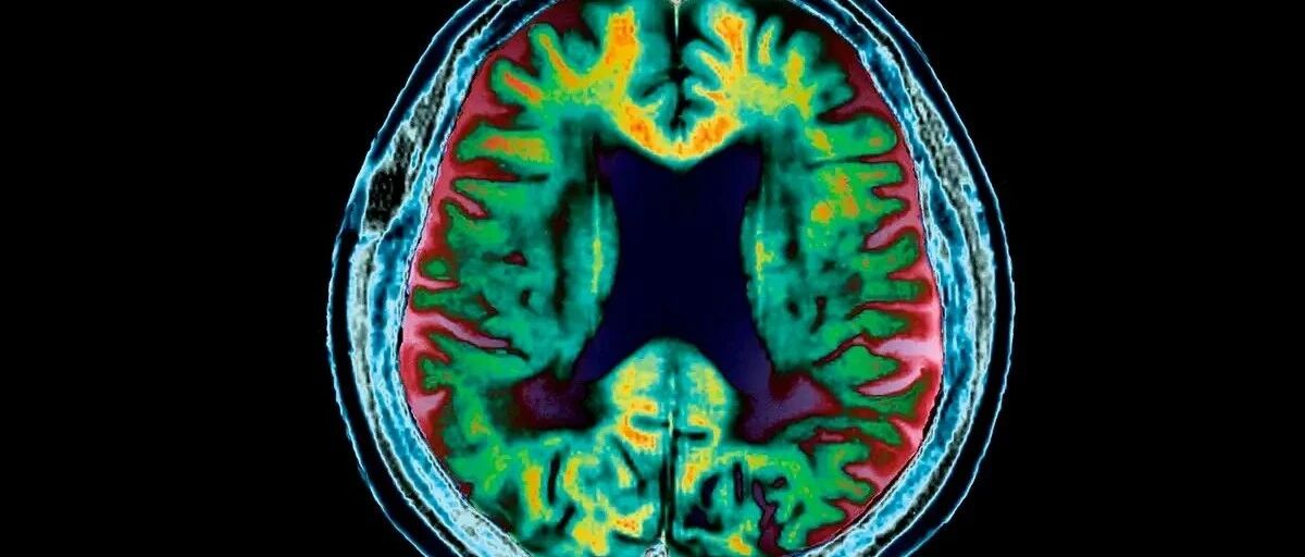 你离痴呆还远吗？