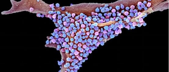 2020年神经领域研究进展盘点丨梅斯述评