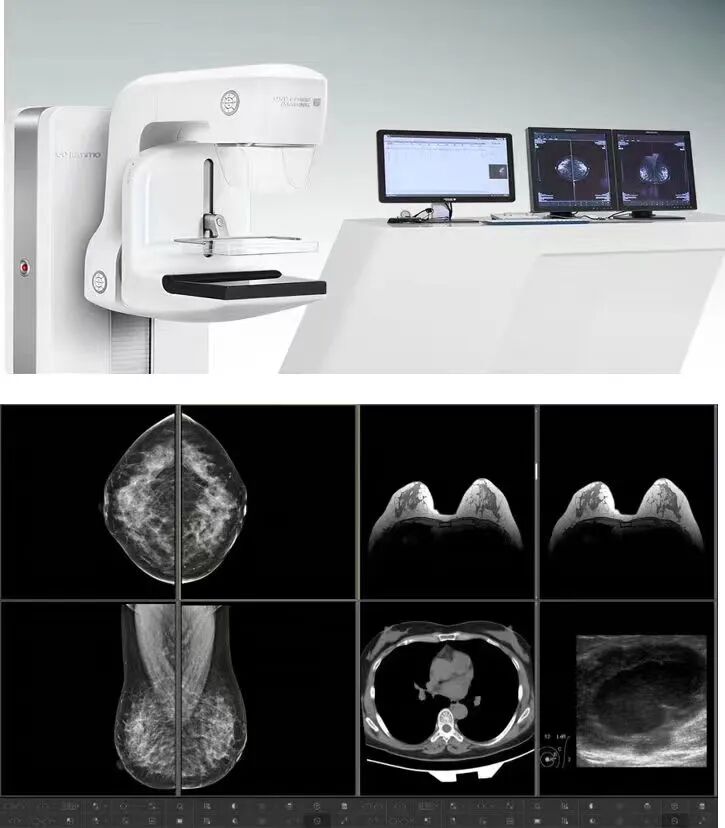 乳腺dr能检查什么【新设备】再添利器！乐平市人民医院新引进乳腺筛查“利器”——三维断层成像数字化乳腺DR_https://www.jmylbn.com_新闻资讯_第5张