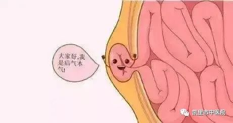 【市中医】什么是疝气？该怎么治疗？