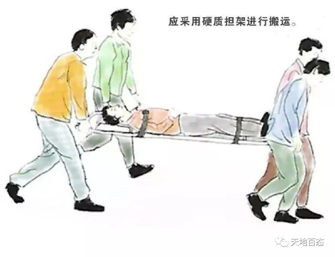 担架注意哪些事项各类患者受伤及发病后如何搬运，一文搞定！_https://www.jmylbn.com_新闻资讯_第3张
