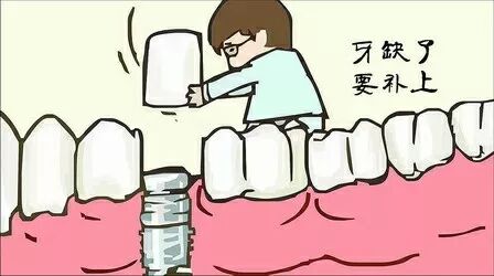 一分钟带你走出种植牙误区