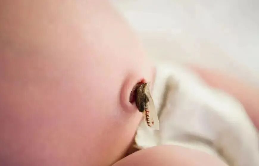 为什么剪脐带要先夹住剪脐带是宝宝疼还是妈妈疼？_https://www.jmylbn.com_新闻资讯_第4张