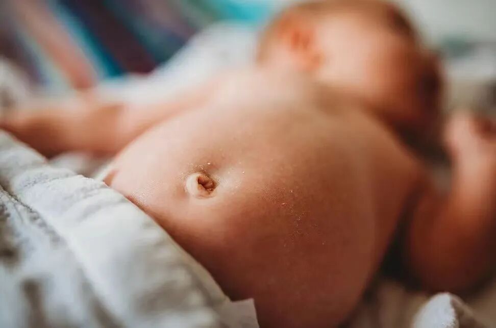 为什么剪脐带要先夹住剪脐带是宝宝疼还是妈妈疼？_https://www.jmylbn.com_新闻资讯_第13张