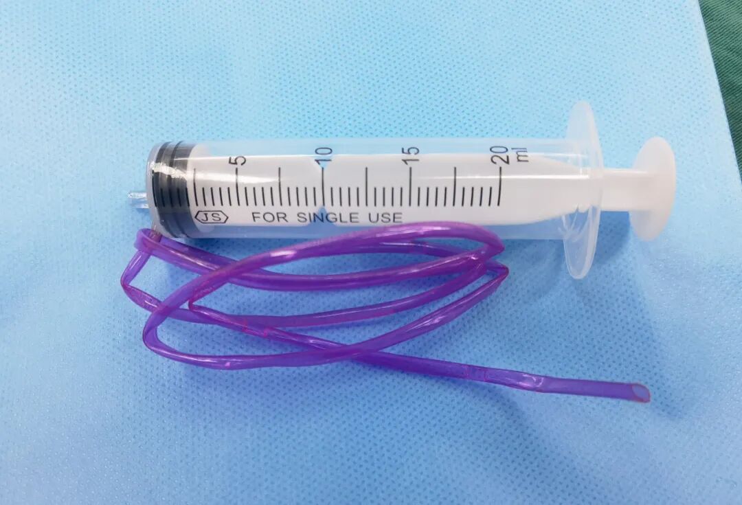 痛！十一岁男孩将66厘米塑料管完全插入尿道！