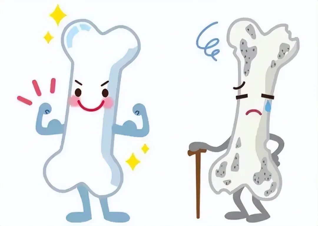 成人怎么检测骨密度骨骼健康，一照便知 ｜ 凭祥市人民医院新开展骨密度检测项目_https://www.jmylbn.com_新闻资讯_第10张