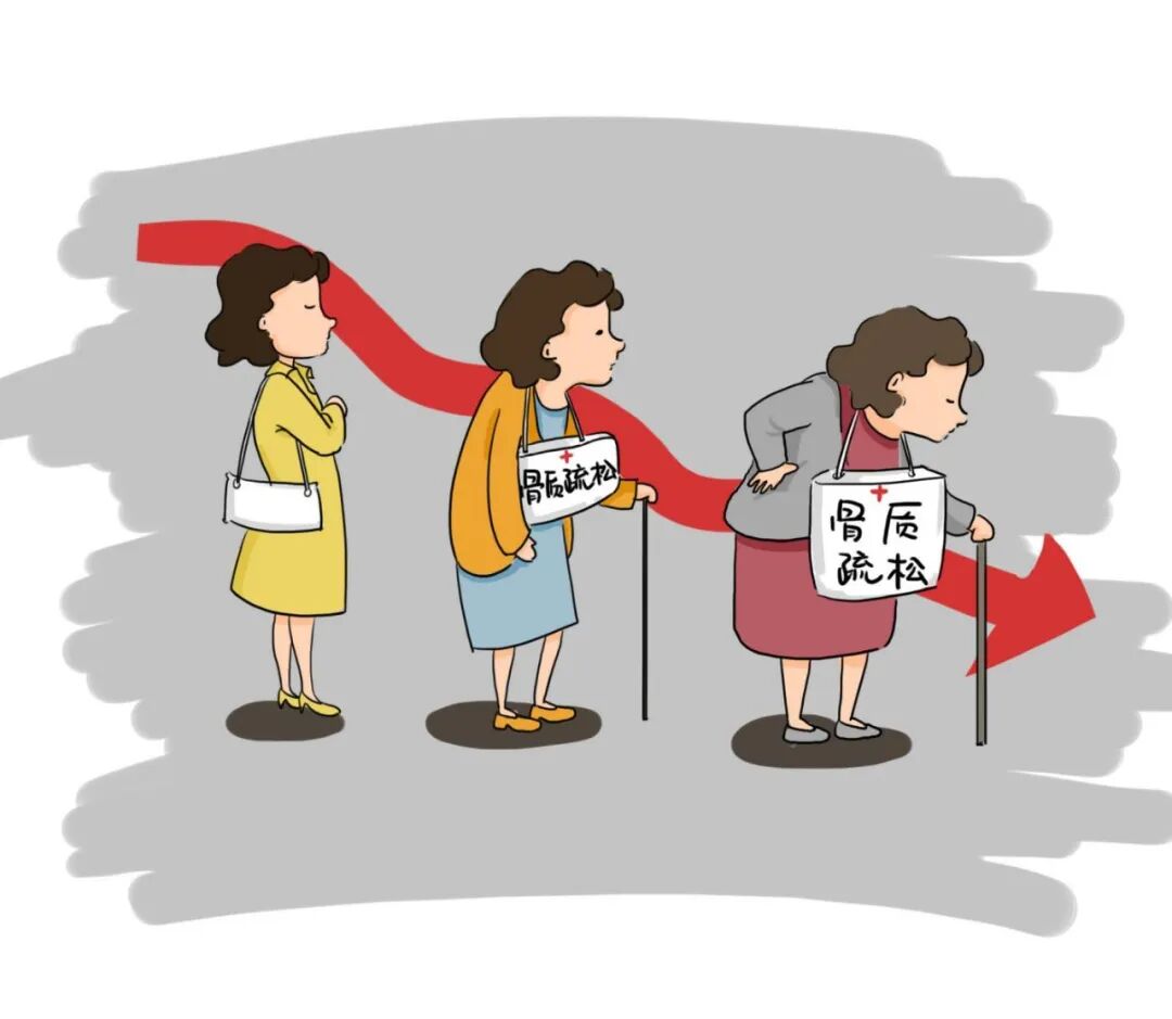 成人怎么检测骨密度骨骼健康，一照便知 ｜ 凭祥市人民医院新开展骨密度检测项目_https://www.jmylbn.com_新闻资讯_第11张