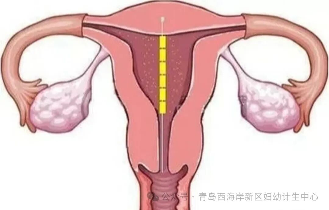 吉妮致美节育环怎么样女性专栏｜“不离不弃”的好伙伴——吉妮致美_https://www.jmylbn.com_新闻资讯_第5张