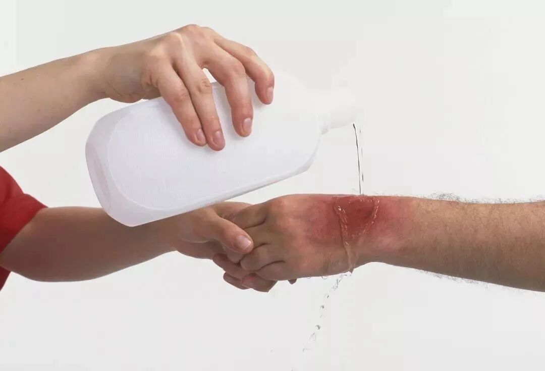 清创包内有什么器械清洗液、消毒剂及清创方法的选择_https://www.jmylbn.com_新闻资讯_第7张