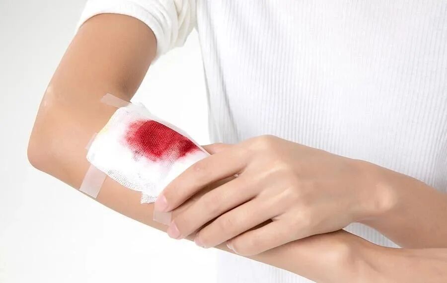 清创包内有什么器械清洗液、消毒剂及清创方法的选择_https://www.jmylbn.com_新闻资讯_第2张