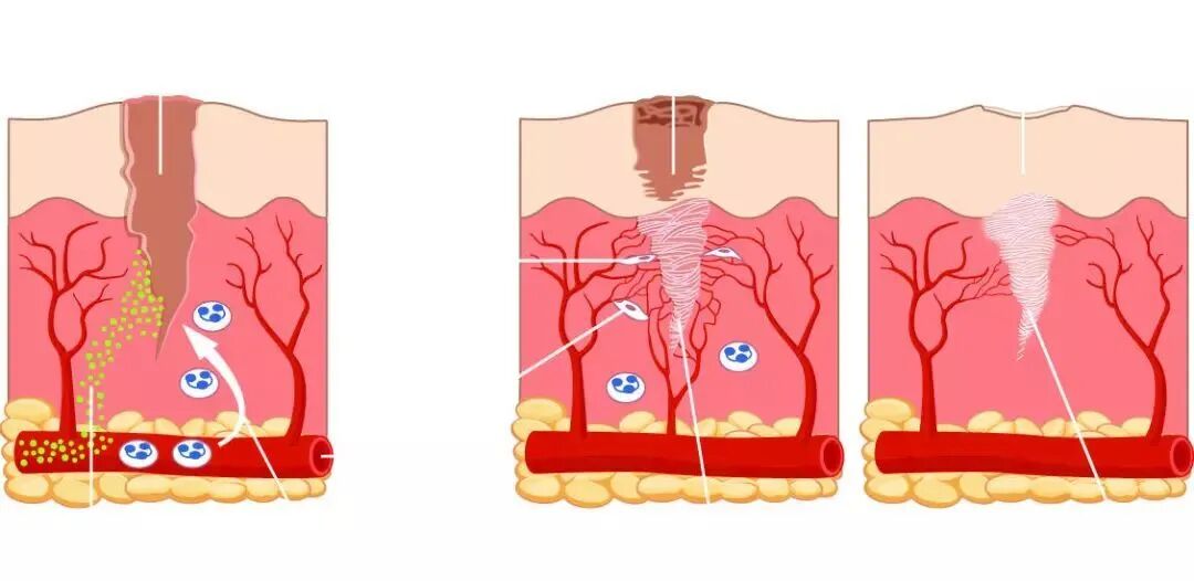 德维可怎么用德维可外用结合TDP照射对颅脑外伤伴皮肤擦伤患者症状改善情况的影响_https://www.jmylbn.com_新闻资讯_第6张