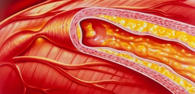 抗菌清创敷料怎么使用伤口知识：影响伤口愈合的因素及伤口床准备_https://www.jmylbn.com_新闻资讯_第3张