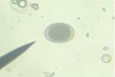 放养鸡体内寄生虫调查及防制措施探讨