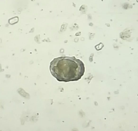 规模化猪场肠道寄生虫普查及处理方案 规模化猪场肠道寄生虫普查及处理方案