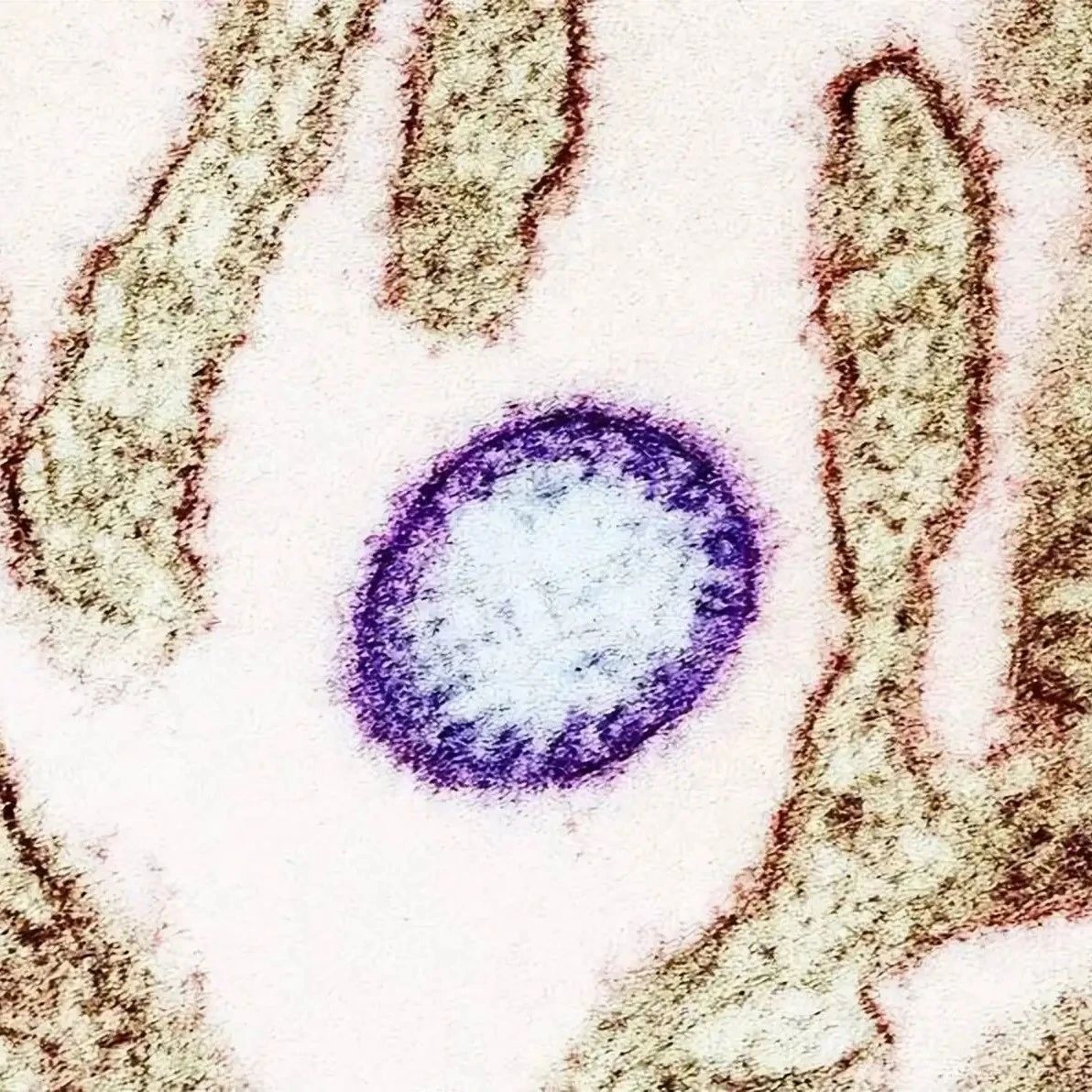 中国发现新病毒“LayV”！山东河南已知35例感染！