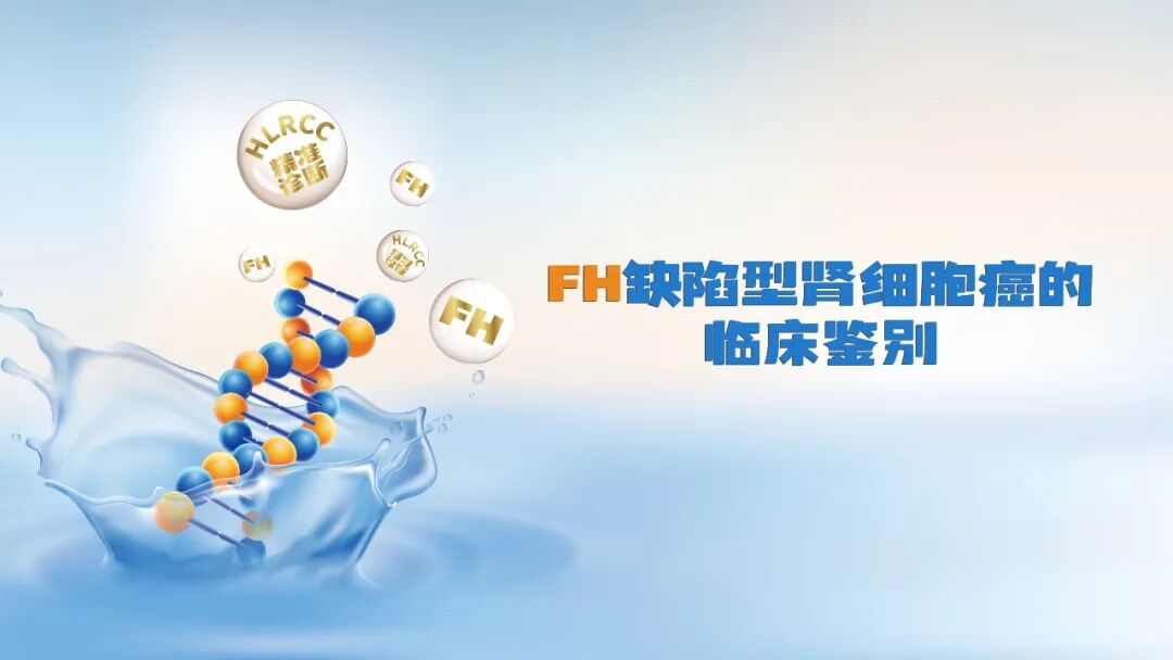 fh染色是什么意思FH缺陷型肾细胞癌的临床鉴别_https://www.jmylbn.com_新闻资讯_第2张
