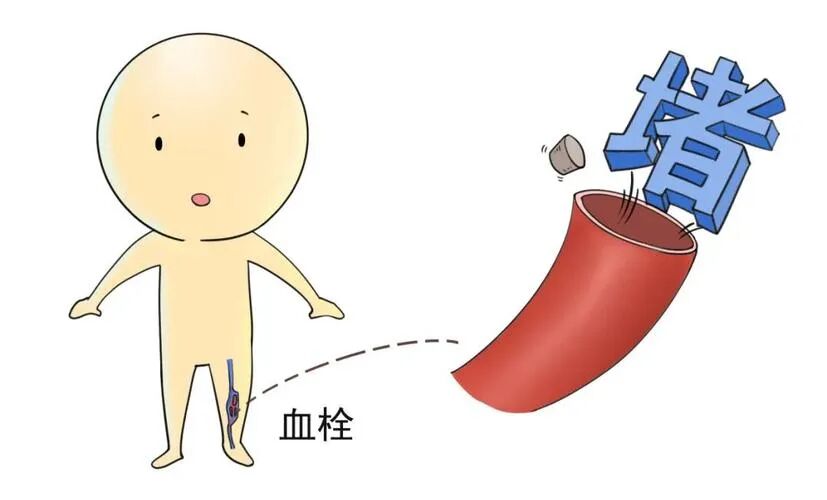 气压治疗仪怎么消毒长期卧床患者的神器——空气压力波治疗仪_https://www.jmylbn.com_新闻资讯_第1张